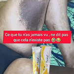 Charger l'image dans la galerie, Fevicid Crème – Anti-Mycoses, Tâches Noires et Boutons de Rasage
